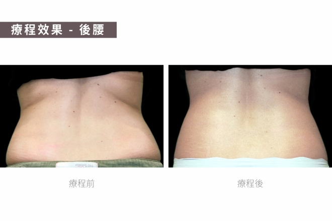 減肥纖體瘦身修身_TM圖-04