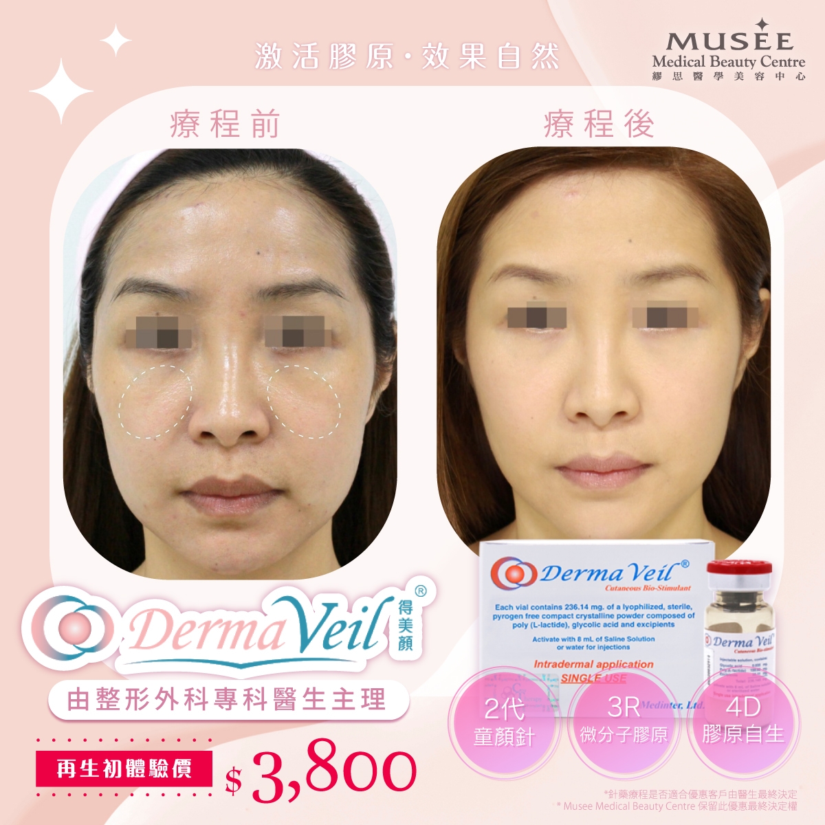 本頁圖片/檔案 - MMBC Post - DV before after_工作區域 1